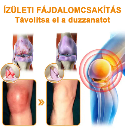 ✅✅Hivatalos Áruház: Ourlyard™ Magnézium Olaj és Méhméreg ízületjavító spray 👨‍⚕️ A Gyógyszerügyi Hivatal (OGYEI) jóváhagyásával