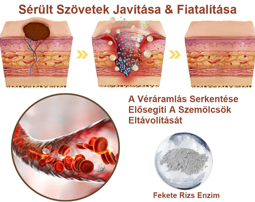 ✅ Zvoevo® Fekete Rizses Bőrregeneráló Krém 👨‍⚕️ (Szemölcsök, bőrkinövések, foltok és hiperpigmentáció kezelésére)🍀