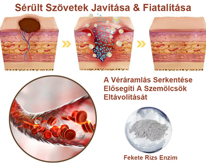 ✅ Zvoevo® Fekete Rizses Bőrregeneráló Krém 👨‍⚕️ (Szemölcsök, bőrkinövések, foltok és hiperpigmentáció kezelésére)🍀