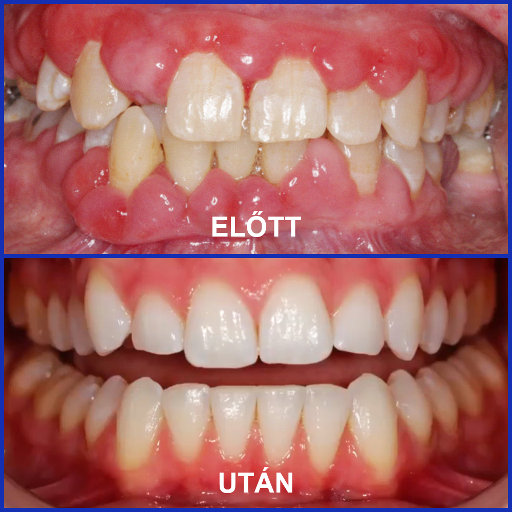 🌟Rolimey® VioCore Méhméreg Fogkezelő Fogkrém