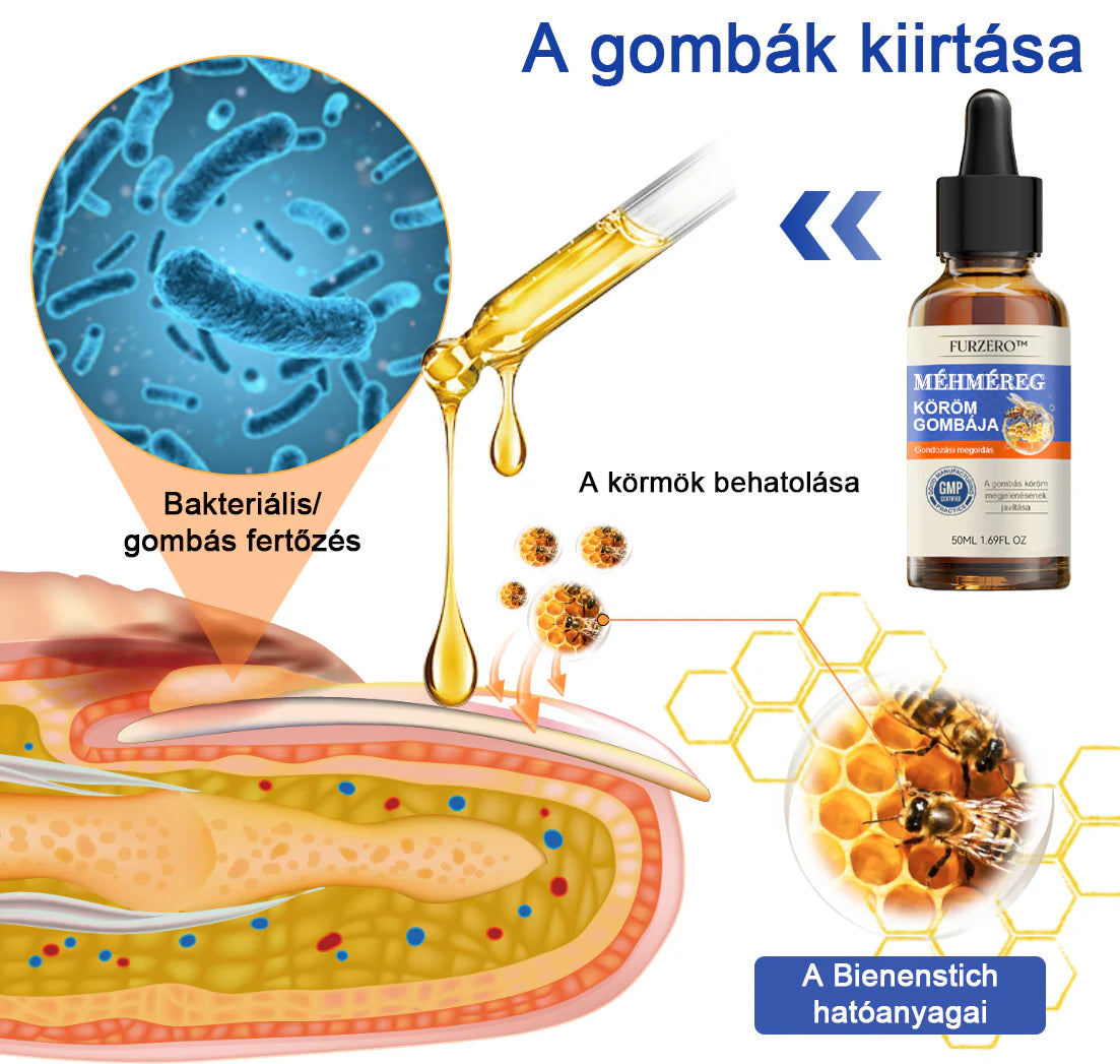 🐝Furzero™ Méhméreg Körömgomba Kezelőoldat: Teljes megoldás a körömgomba problémájára🌟👣👣