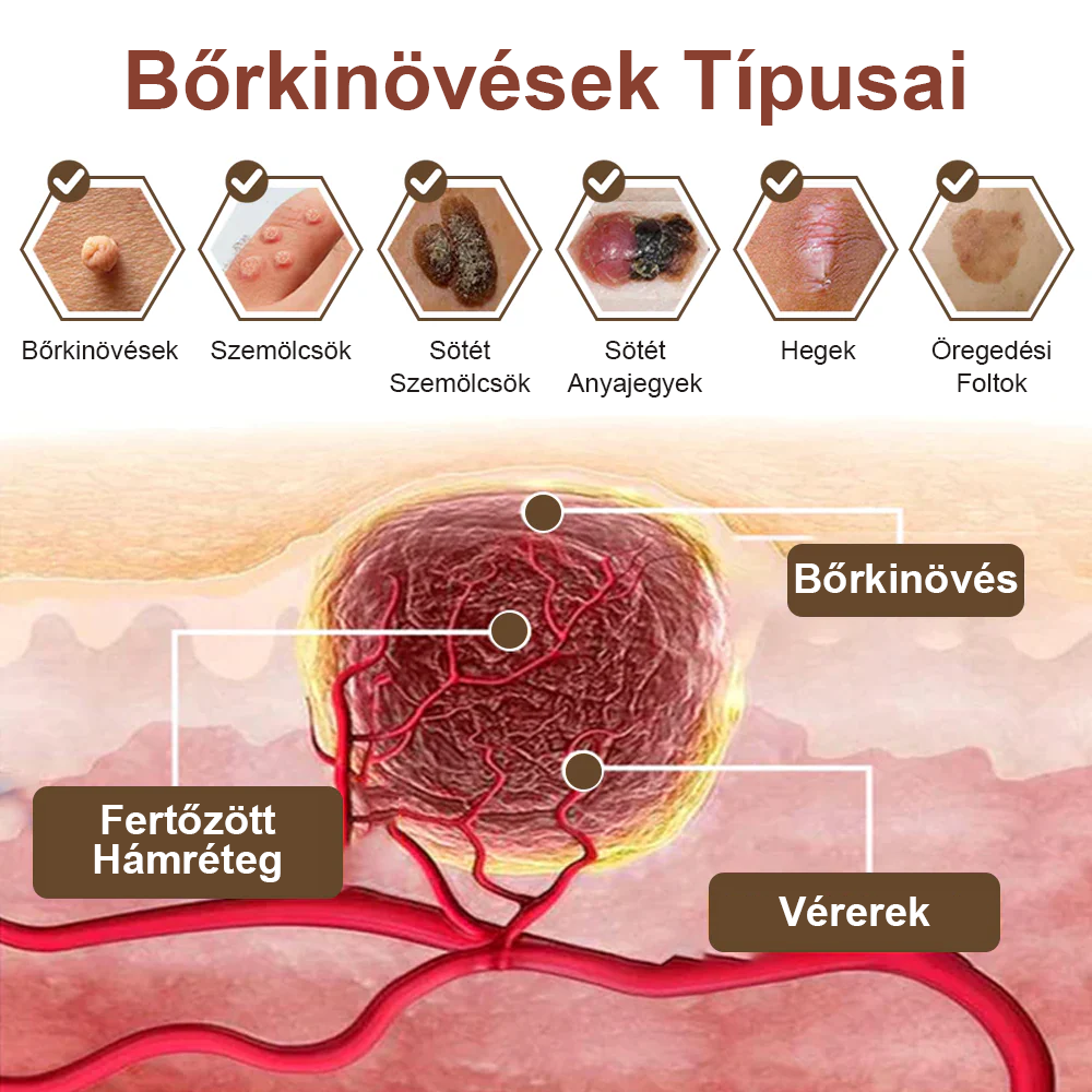 ✅ Zvoevo® Fekete Rizses Bőrregeneráló Krém 👨‍⚕️ (Szemölcsök, bőrkinövések, foltok és hiperpigmentáció kezelésére)🍀