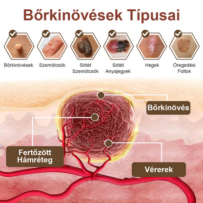 ✅ Zvoevo® Fekete Rizses Bőrregeneráló Krém 👨‍⚕️ (Szemölcsök, bőrkinövések, foltok és hiperpigmentáció kezelésére)🍀