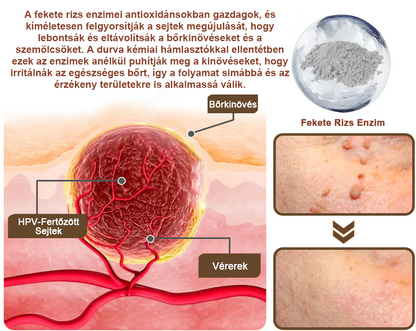 ✅ Zvoevo® Fekete Rizses Bőrregeneráló Krém 👨‍⚕️ (Szemölcsök, bőrkinövések, foltok és hiperpigmentáció kezelésére)🍀