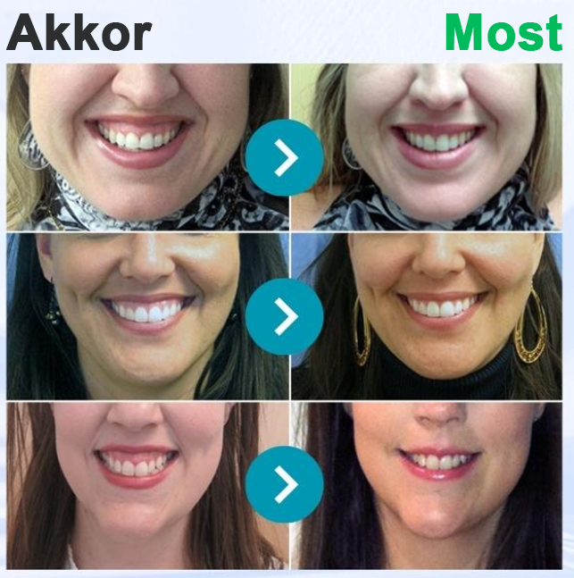 🌟Rolimey® VioCore Méhméreg Fogkezelő Fogkrém