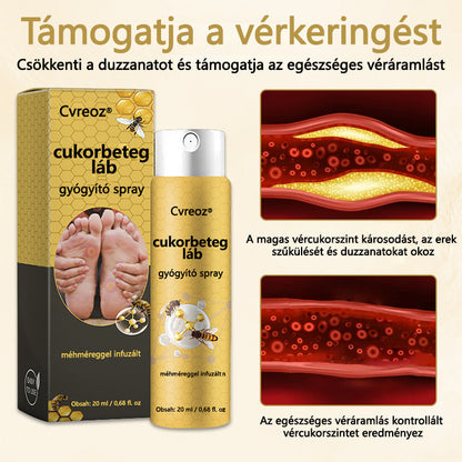 Cvreoz® méhméreg gyógyító spray a sebek gyógyulására és regenerálására a kezeken és a lábakon🌿🌿🌿