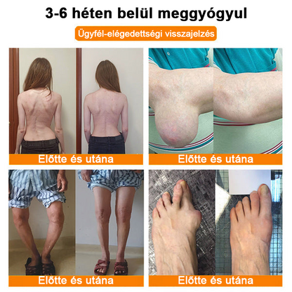 ✅✅Hivatalos Áruház: Ourlyard™ Magnézium Olaj és Méhméreg ízületjavító spray 👨‍⚕️ A Gyógyszerügyi Hivatal (OGYEI) jóváhagyásával