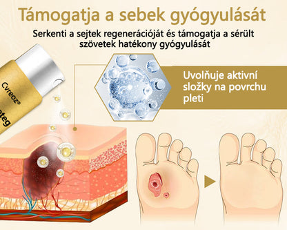 Cvreoz® méhméreg gyógyító spray a sebek gyógyulására és regenerálására a kezeken és a lábakon🌿🌿🌿