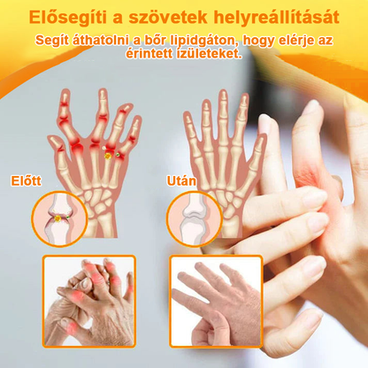 ✅✅Hivatalos Áruház: Ourlyard™ Magnézium Olaj és Méhméreg ízületjavító spray 👨‍⚕️ A Gyógyszerügyi Hivatal (OGYEI) jóváhagyásával