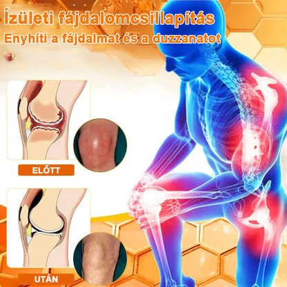 ✅✅Hivatalos Áruház: Ourlyard™ Magnézium Olaj és Méhméreg ízületjavító spray 👨‍⚕️ A Gyógyszerügyi Hivatal (OGYEI) jóváhagyásával